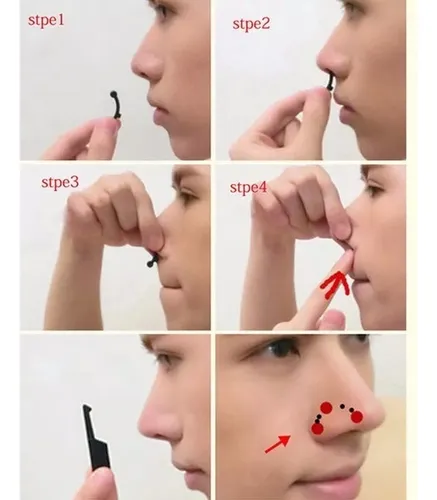 CO110689 Corrector Respingador Nariz x3 - Imagen 3